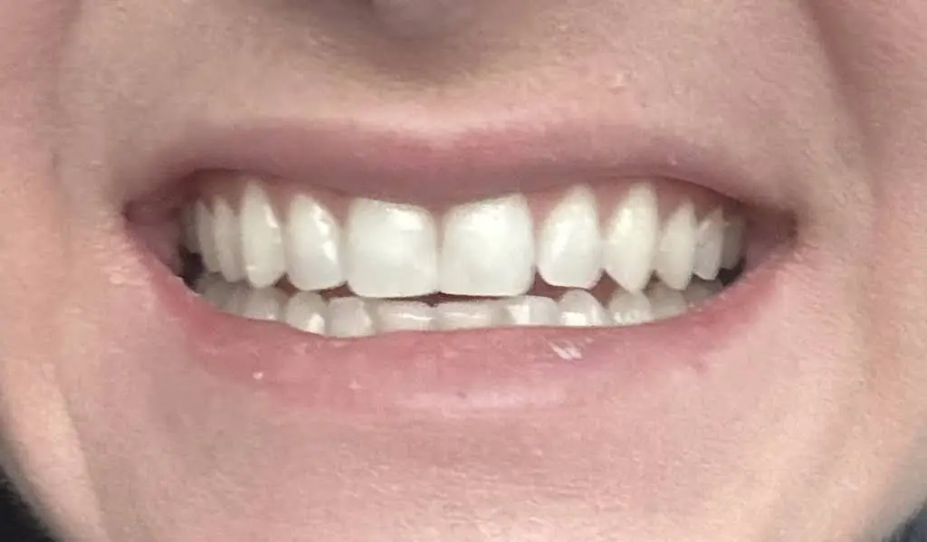 Sommers Family Dentistry
