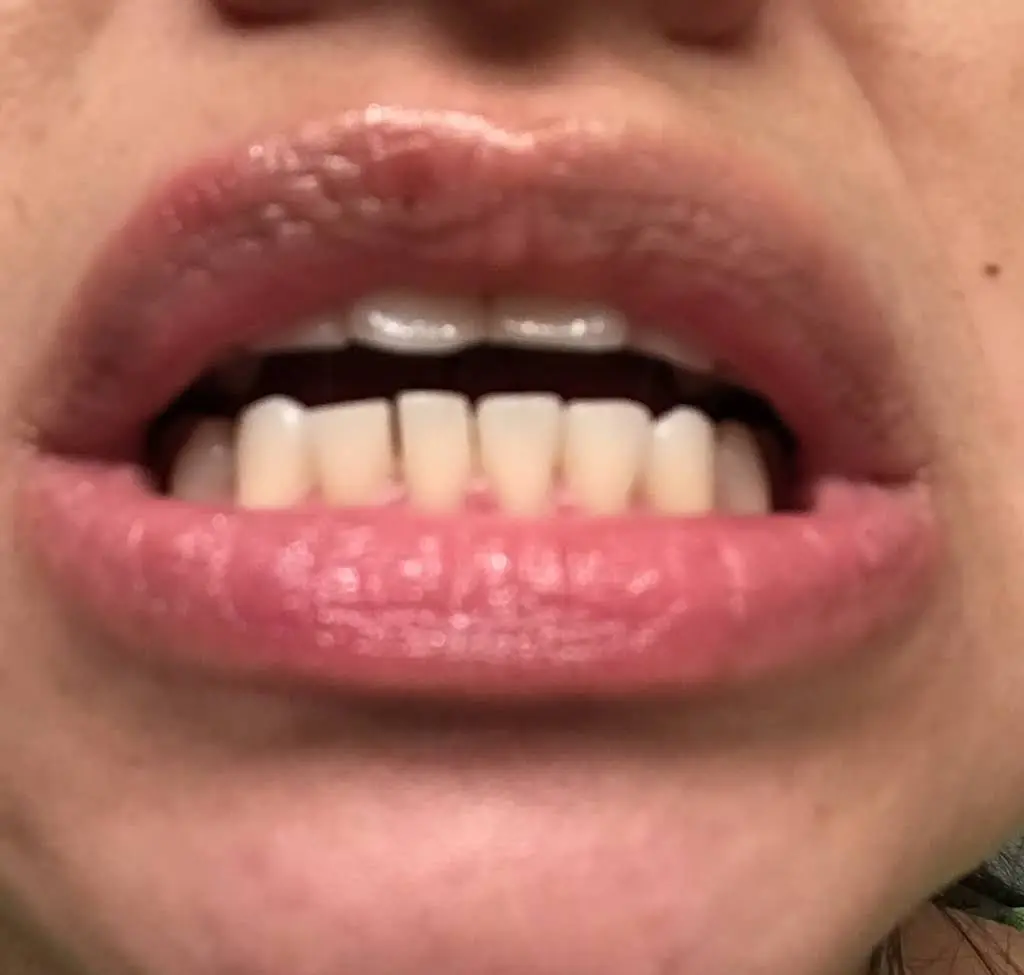 Westview Dental Center and Fastbraces®
