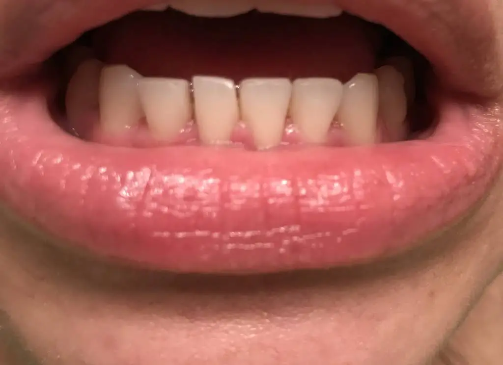 Westview Dental Center and Fastbraces®