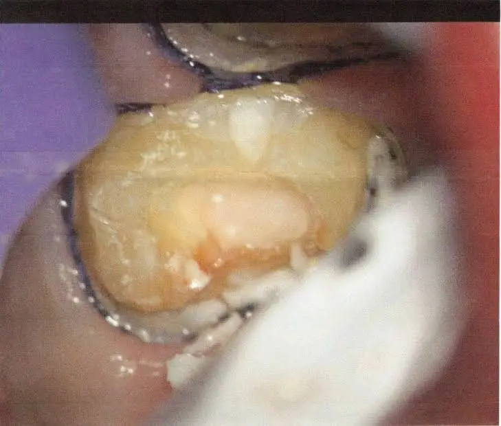 Aspen Dental