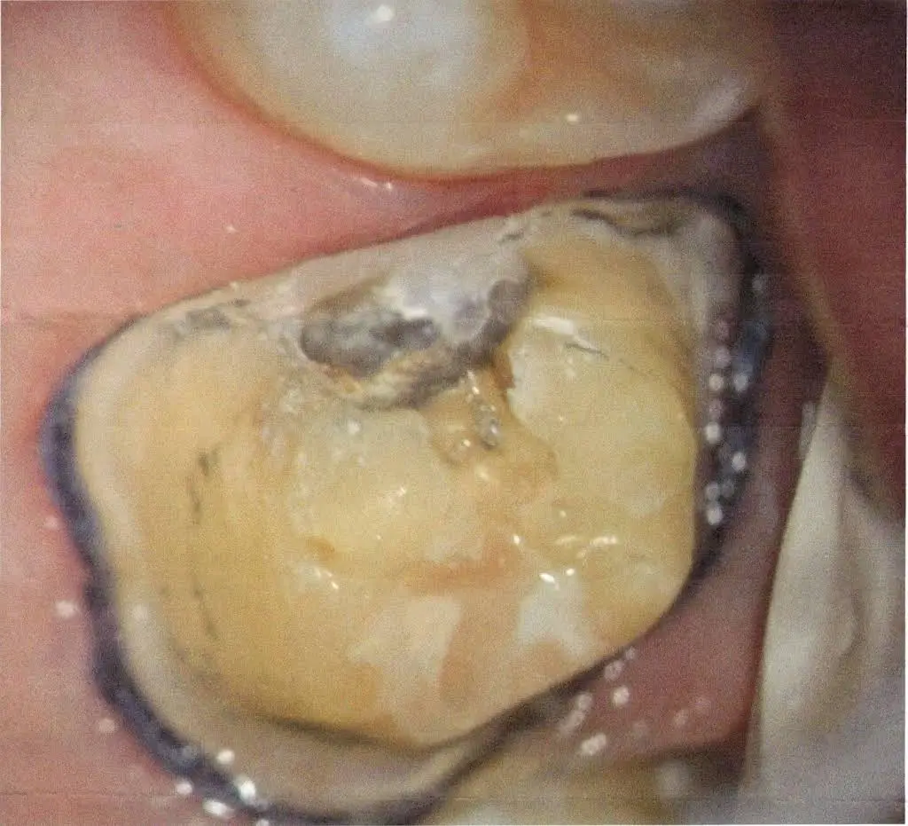 Aspen Dental