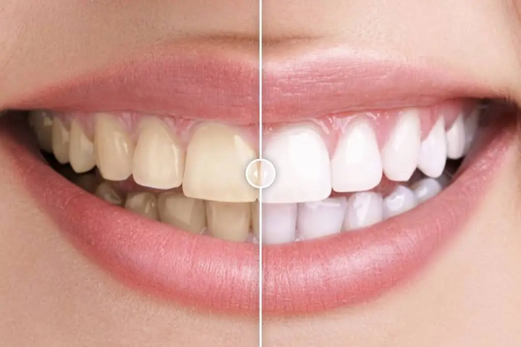 Smilee Dental Centre