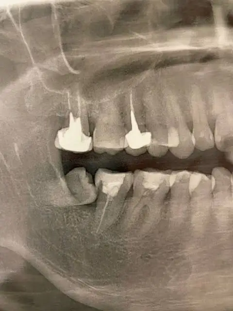 CVOS Oral Surgery