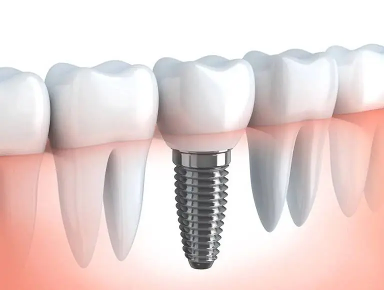 Rockwest Dental Clinic Mississauga