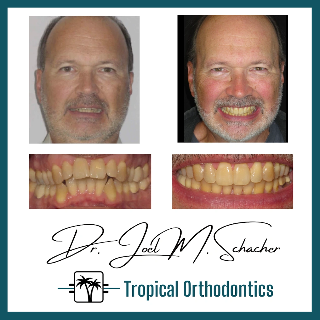 Tropical Orthodontics - Dr. Joel Schacher