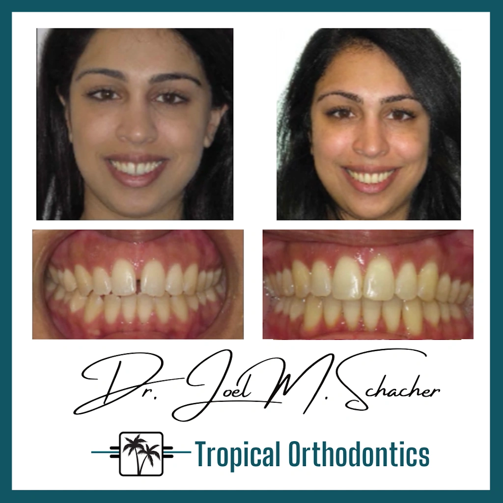 Tropical Orthodontics - Dr. Joel Schacher