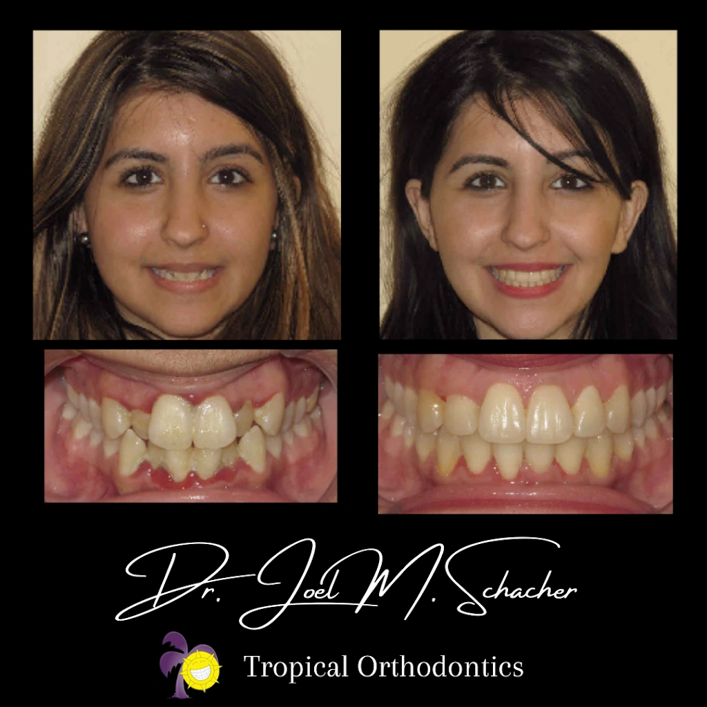 Tropical Orthodontics - Dr. Joel Schacher