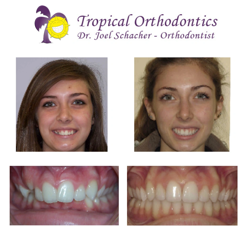 Tropical Orthodontics - Dr. Joel Schacher
