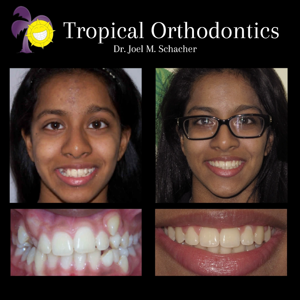 Tropical Orthodontics - Dr. Joel Schacher