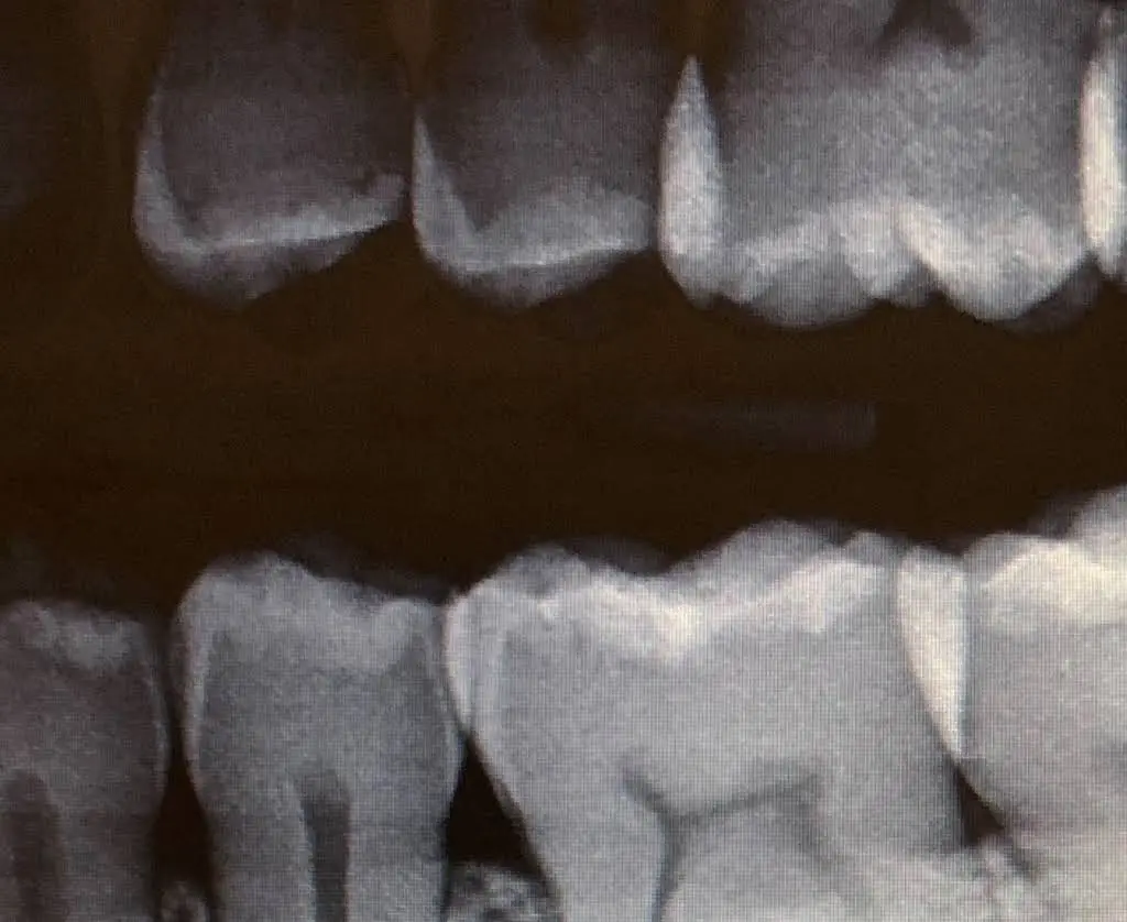 Dawson Dental Centre-Aurora