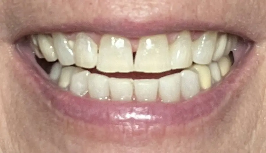 Thornhill Family Smiles Dental