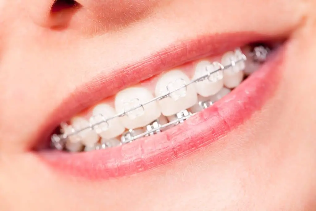 Richmond Hill Kids Dentistry and Orthodontics