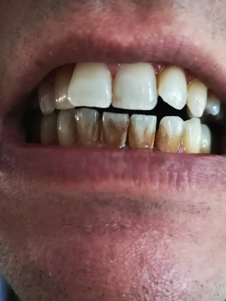 Glen Abbey Smiles Dental Hygiene
