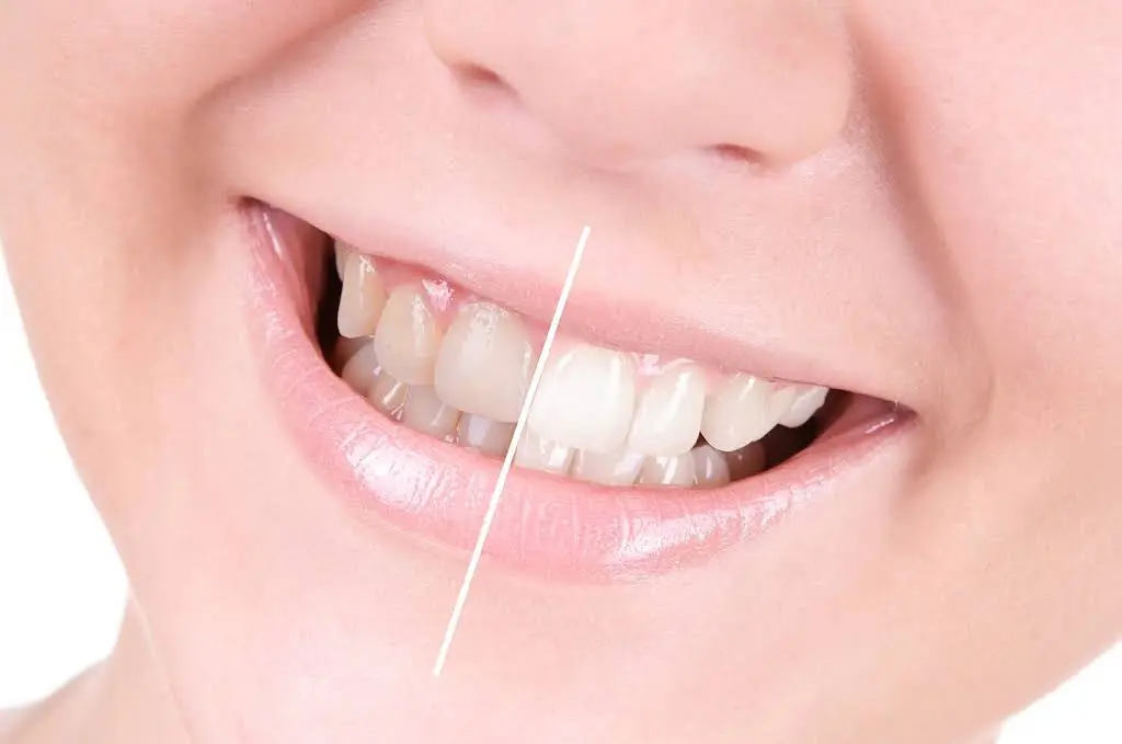 L.A.N.U. Dental