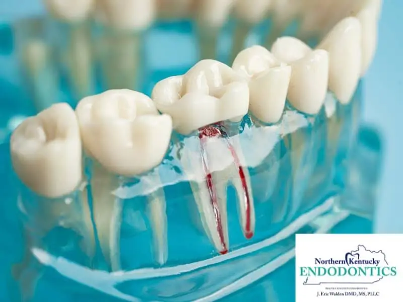 Northern Kentucky Endodontics