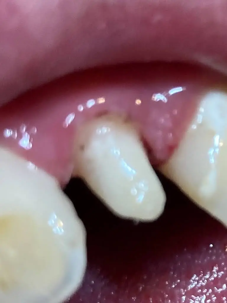 Aspen Dental