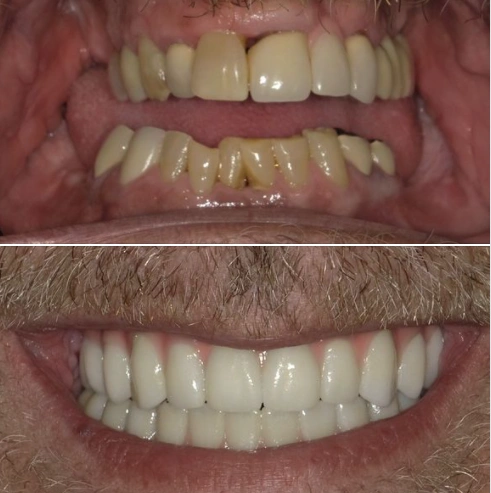 Wright Dental Center
