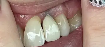 Mettens and Stewart Dental