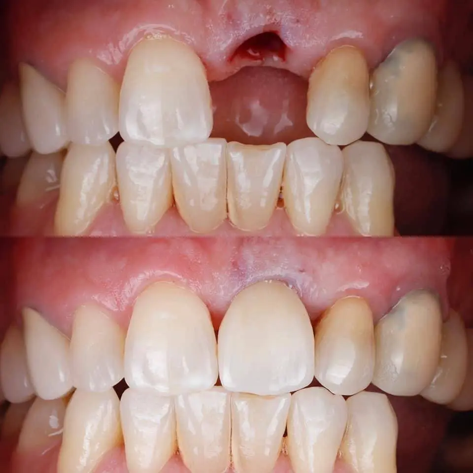Zealous Dental Columbus