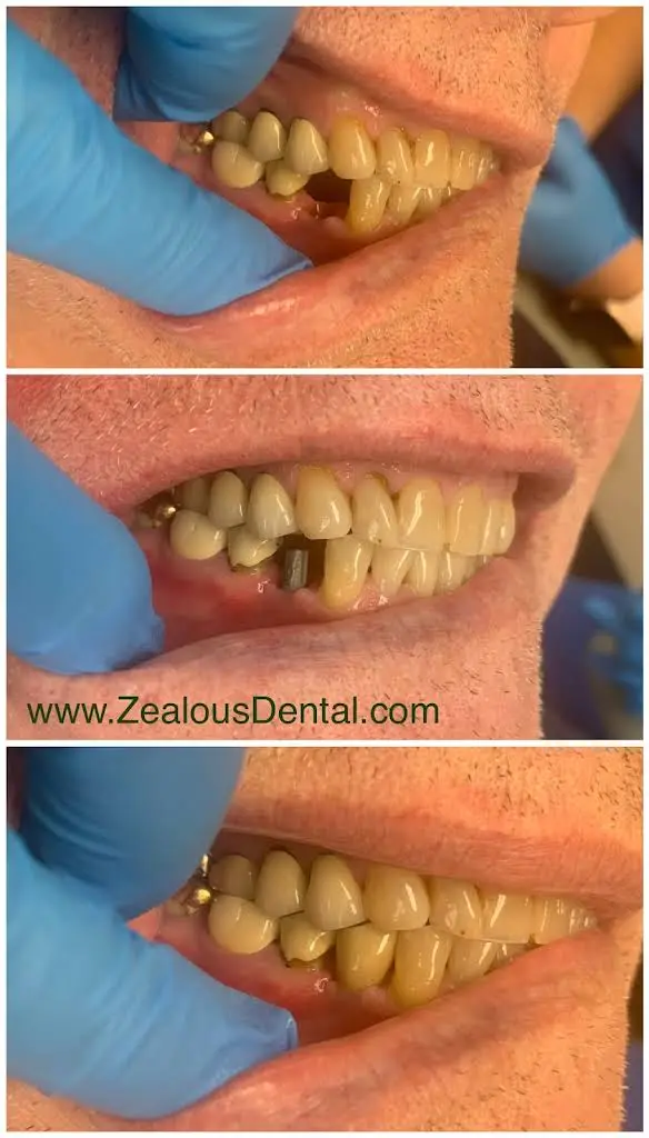Zealous Dental Columbus