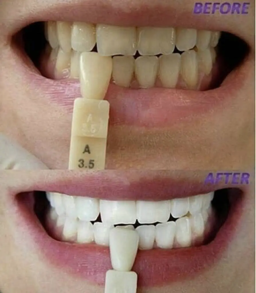 Walk In Dental Clinic