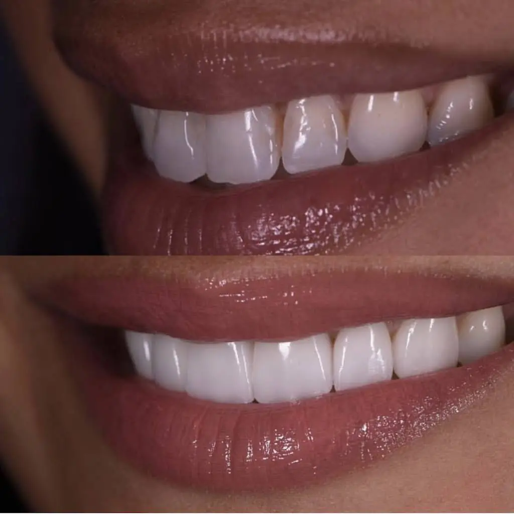 Walk In Dental Clinic