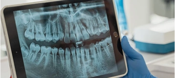 Dr. Monte Tator Dentistry Toronto