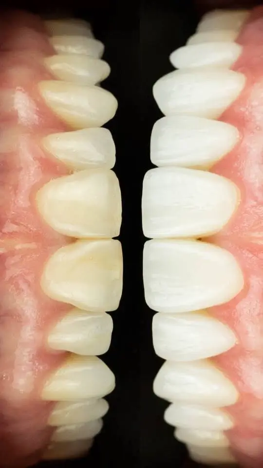 Pearce Dental Group