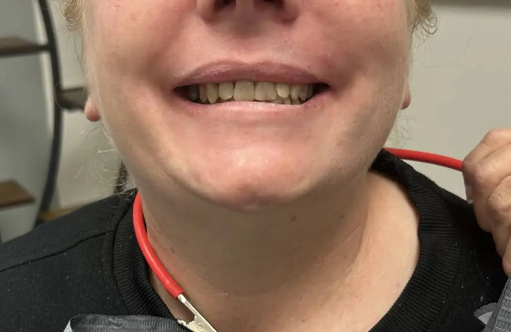 Indiana Emergency Dental Bloomington