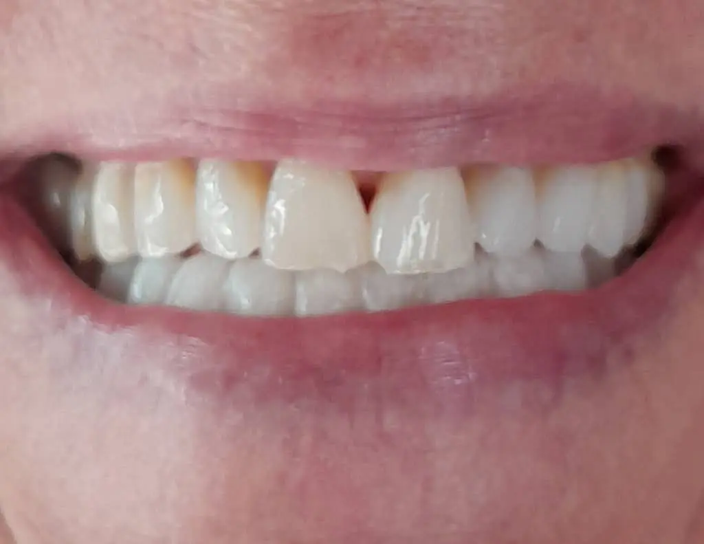 Hart Dental Group: Steven Hart DDS