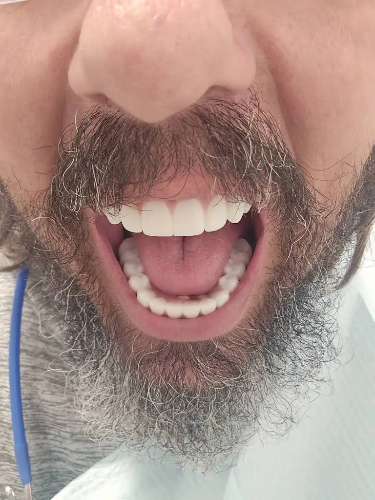 Nuvia Dental Implant Center