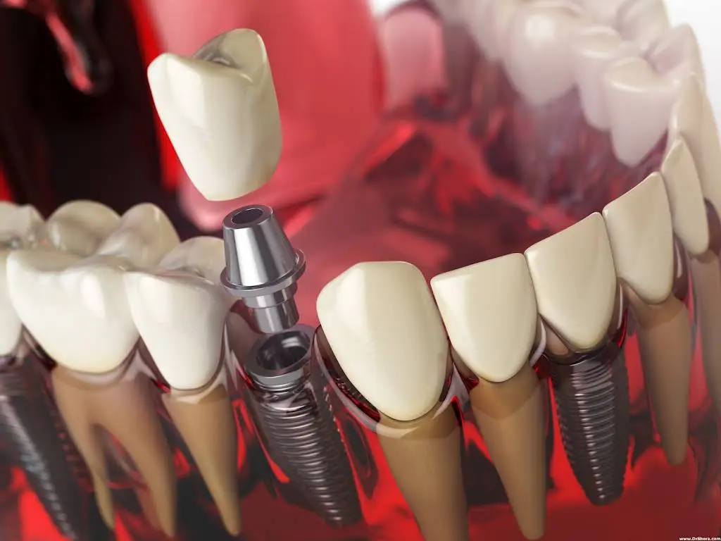 Dr. Saima Shora Dentistry