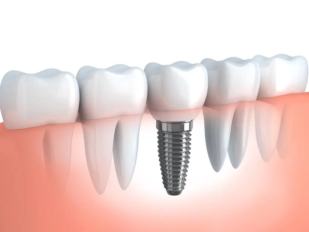 Li Family Dental
