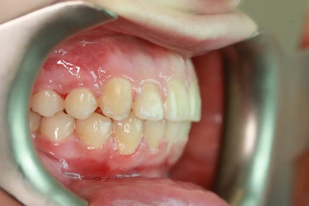 Eatonville Dental