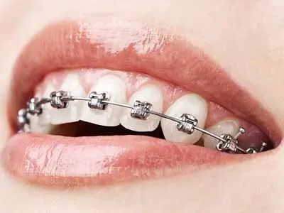Dr. Yu Dental Office Thornhill