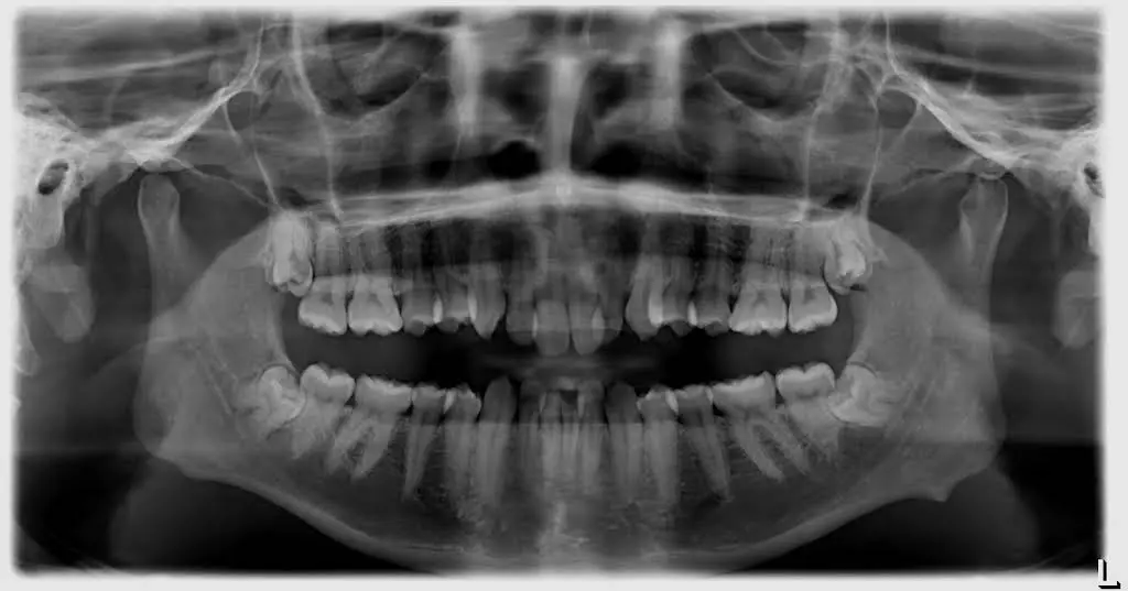 Bayview Hill Centre Dental 富豪中心牙科