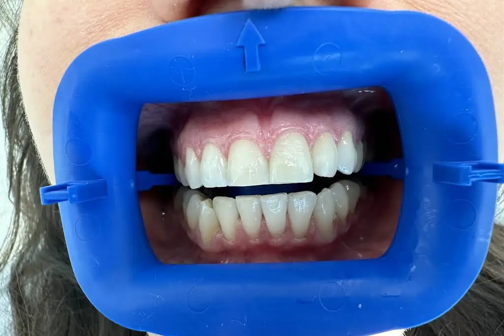 Dentalship Dentistry