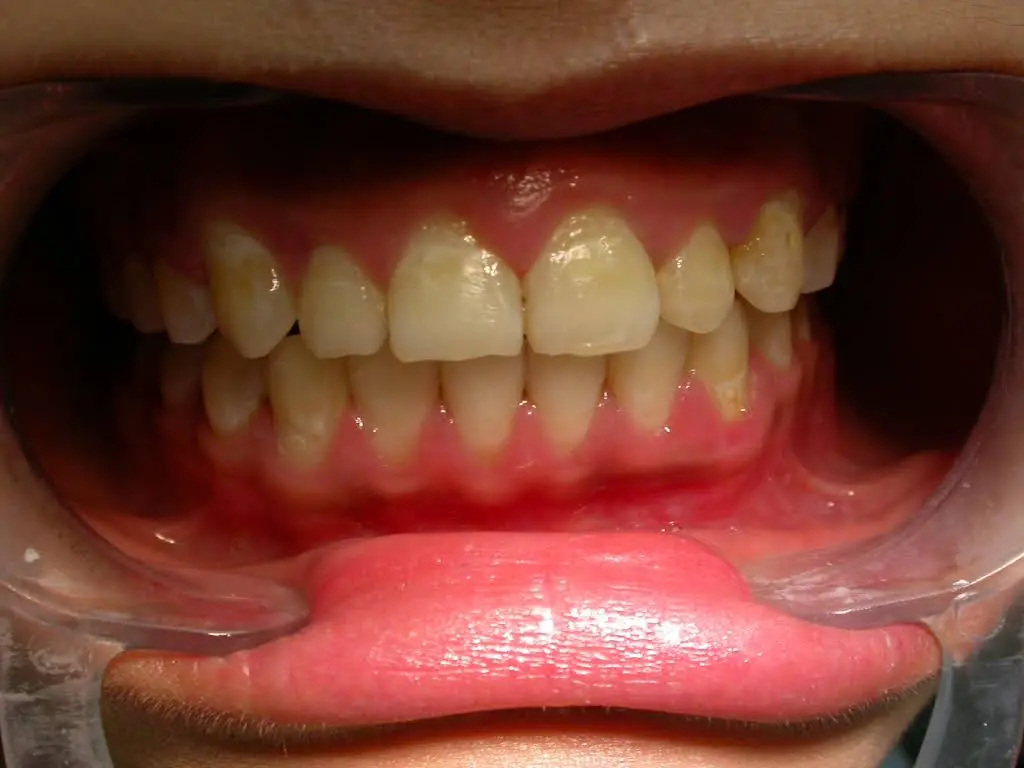 Dr. A Seth Dentistry