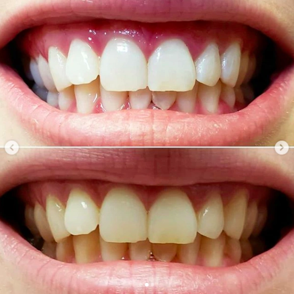 Dentist Near Me - Bathurst