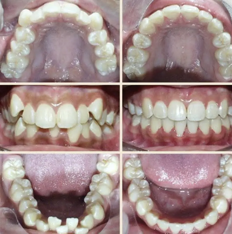 Johnson Orthodontics