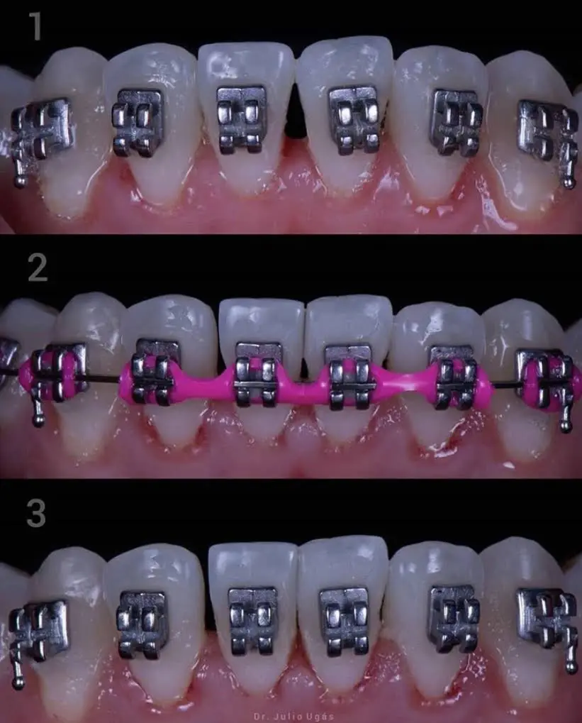 Johnson Orthodontics