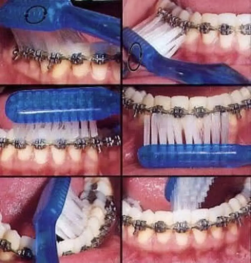 Johnson Orthodontics