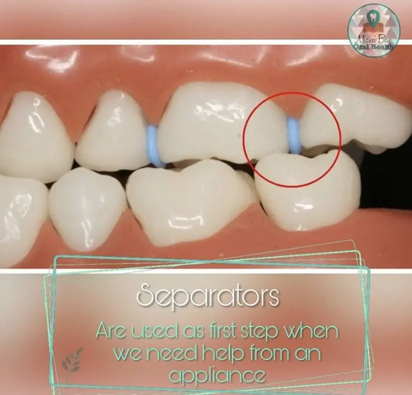 Johnson Orthodontics