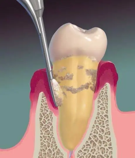 Advanced Dentistry of Blue Ash