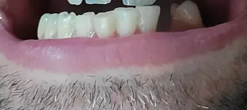 ClearChoice Dental Implant Center
