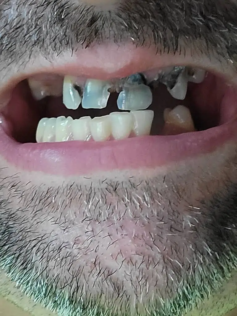 ClearChoice Dental Implant Center