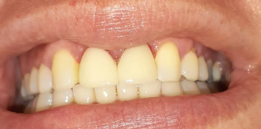 Merrill Dental