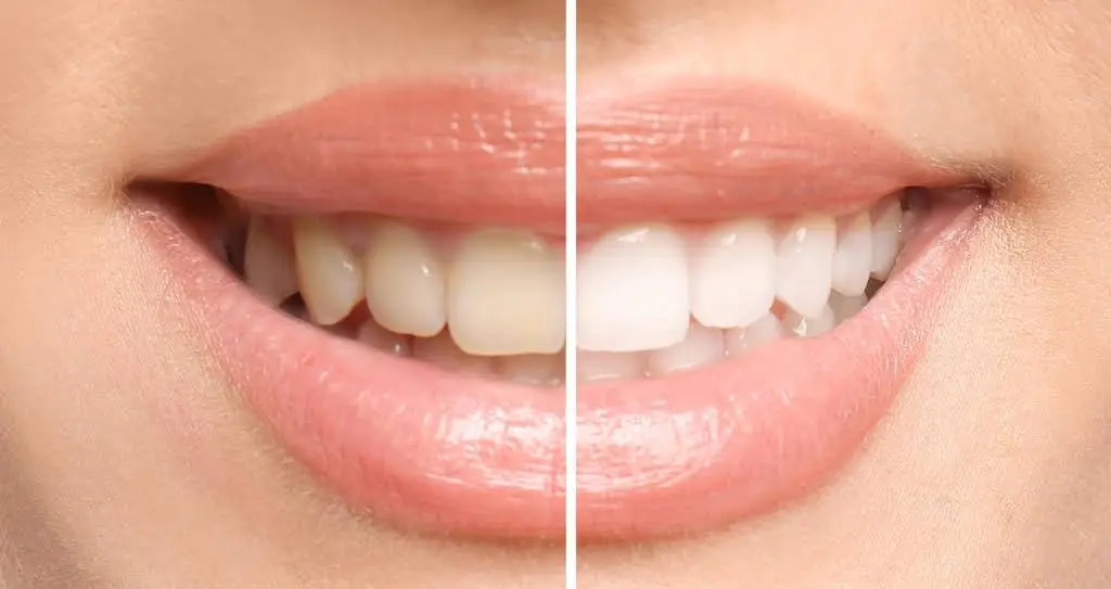 Hayden Family Dental - Rebecca Hayden DMD