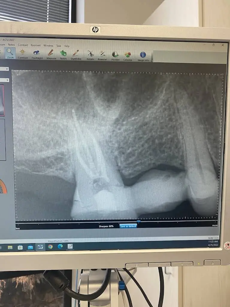 Indianapolis Endodontics PC