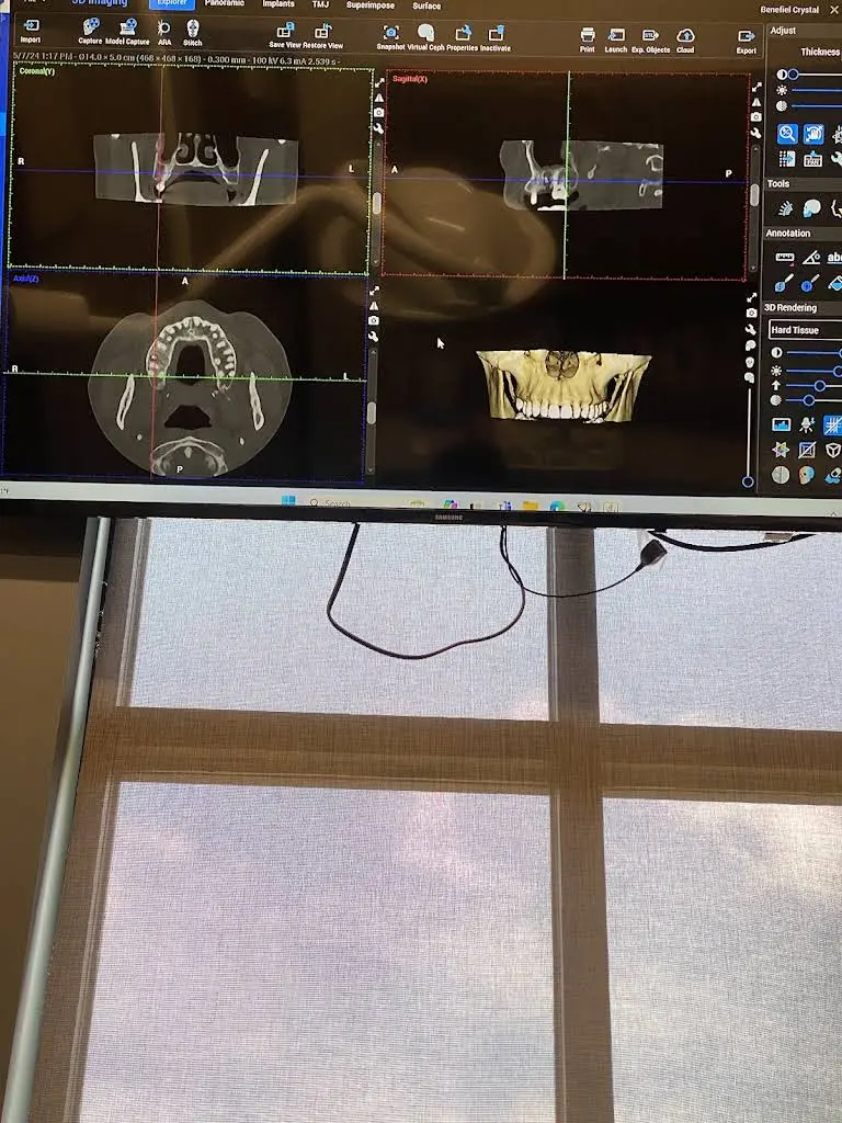 Bloomington Oral Surgery